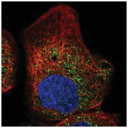 HSD17B4 Rabbit anti-Human, Polyclonal Antibody, Abnova 100&mu;L; Unlabeled:Antibodies,