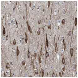 WDR60 Rabbit anti-Human, Polyclonal Antibody, Abnova 100 &mu;L | Buy Online | Abnova Corporation | Fisher Scientific