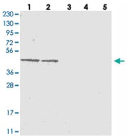 IGF2BP1, Rabbit, Polyclonal Antibody, Abnova 100 &mu;L | Buy Online | Abnova Corporation | Fisher Scientific