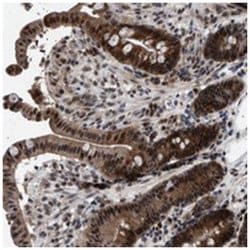 IGF2BP1, Rabbit, Polyclonal Antibody, Abnova 100 &mu;L | Buy Online | Abnova Corporation | Fisher Scientific