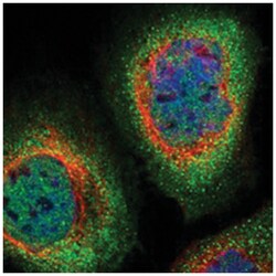 IGF2BP1, Rabbit, Polyclonal Antibody, Abnova 100 &mu;L | Buy Online | Abnova Corporation | Fisher Scientific