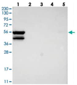 MKS1 Rabbit anti-Human, Polyclonal Antibody, Abnova 100 &mu;L | Buy Online | Abnova Corporation | Fisher Scientific