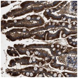BLOC1S1, Rabbit, Polyclonal Antibody, Abnova 100&mu;L; Unlabeled:Antibodies,