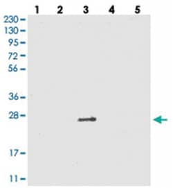 VSTM2A Rabbit anti-Human, Polyclonal Antibody, Abnova 100 &mu;L | Buy Online | Abnova Corporation | Fisher Scientific
