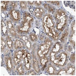 VSTM2A Rabbit anti-Human, Polyclonal Antibody, Abnova 100 &mu;L | Buy Online | Abnova Corporation | Fisher Scientific