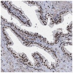 PHF12, Rabbit, Polyclonal Antibody, Abnova 100 &mu;L | Buy Online | Abnova | Fisher Scientific