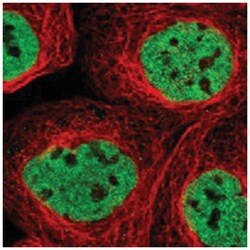 PHF12, Rabbit, Polyclonal Antibody, Abnova 100 &mu;L | Buy Online | Abnova | Fisher Scientific