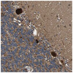 MRPL27, Rabbit, Polyclonal Antibody, Abnova 100 &mu;L | Buy Online | Abnova Corporation | Fisher Scientific