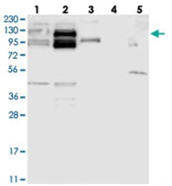 CYTSB Rabbit anti-Human, Polyclonal Antibody, Abnova 100 &mu;L | Buy Online | Abnova Corporation | Fisher Scientific