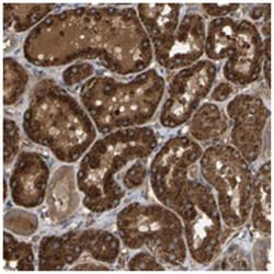 C9orf116 Rabbit anti-Human, Polyclonal Antibody, Abnova 100 &mu;L | Buy Online | Abnova Corporation | Fisher Scientific