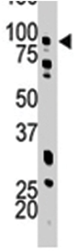 PFKM Rabbit anti-Human, Polyclonal Antibody, Abnova 400&mu;L; Unlabeled:Antibodies,