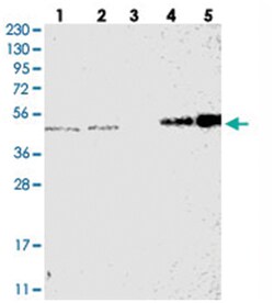 SMAP2 Rabbit anti-Human, Polyclonal Antibody, Abnova 100 &mu;L | Buy Online | Abnova Corporation | Fisher Scientific