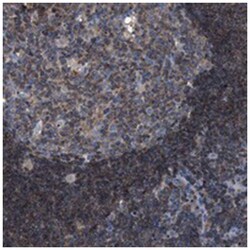SMAP2 Rabbit anti-Human, Polyclonal Antibody, Abnova 100 &mu;L | Buy Online | Abnova Corporation | Fisher Scientific