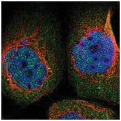 SMAP2 Rabbit anti-Human, Polyclonal Antibody, Abnova 100 &mu;L | Buy Online | Abnova Corporation | Fisher Scientific