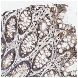 ZADH2, Rabbit, Polyclonal Antibody, Abnova 100&mu;L; Unlabeled:Antibodies,