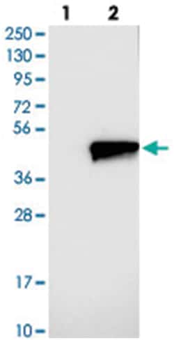 ZADH2, Rabbit, Polyclonal Antibody, Abnova 100&mu;L; Unlabeled:Antibodies,
