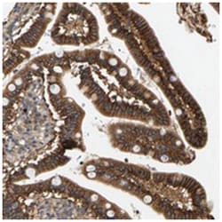 FAM78A Rabbit anti-Human, Polyclonal Antibody, Abnova 100 &mu;L | Buy Online | Abnova Corporation | Fisher Scientific
