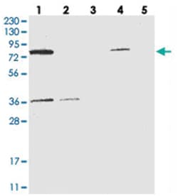 HSD17B4 Rabbit anti-Human, Polyclonal Antibody, Abnova 100 &mu;L | Buy Online | Abnova Corporation | Fisher Scientific