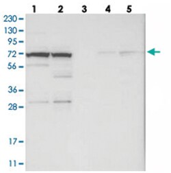 RBM33 Rabbit anti-Human, Polyclonal Antibody, Abnova 100 &mu;L | Buy Online | Abnova Corporation | Fisher Scientific