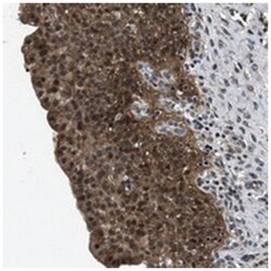 RBM33 Rabbit anti-Human, Polyclonal Antibody, Abnova 100 &mu;L | Buy Online | Abnova Corporation | Fisher Scientific