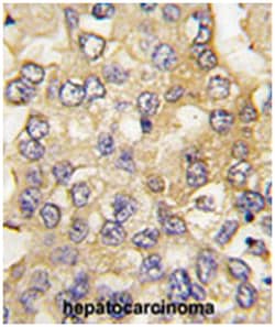 PFKM Rabbit anti-Human, Polyclonal Antibody, Abnova 400&mu;L; Unlabeled:Antibodies,