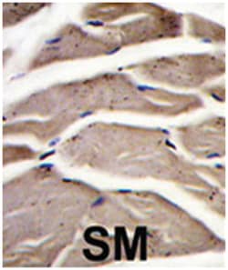 PFKM Rabbit anti-Human, Polyclonal Antibody, Abnova 400&mu;L; Unlabeled:Antibodies,