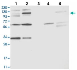 OSBP2 Rabbit anti-Human, Polyclonal Antibody, Abnova 100 &mu;L | Buy Online | Abnova Corporation | Fisher Scientific