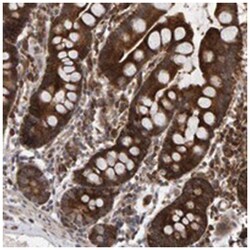 OSBP2 Rabbit anti-Human, Polyclonal Antibody, Abnova 100 &mu;L | Buy Online | Abnova Corporation | Fisher Scientific