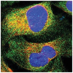 SVEP1 Rabbit anti-Human, Polyclonal Antibody, Abnova 100 &mu;L | Buy Online | Abnova Corporation | Fisher Scientific