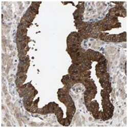 KRTAP27-1, Rabbit, Polyclonal Antibody, Abnova 100 &mu;L | Buy Online | Abnova Corporation | Fisher Scientific