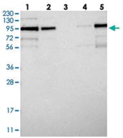 LRCH1, Rabbit, Polyclonal Antibody, Abnova 100 &mu;L | Buy Online | Abnova Corporation | Fisher Scientific
