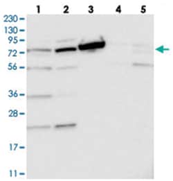 TOP1MT Rabbit anti-Human, Polyclonal Antibody, Abnova 100&mu;L; Unlabeled:Antibodies,
