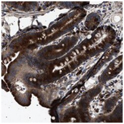 TOP1MT Rabbit anti-Human, Polyclonal Antibody, Abnova 100&mu;L; Unlabeled:Antibodies,