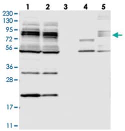 MAK10, Rabbit, Polyclonal Antibody, Abnova 100 &mu;L | Buy Online | Abnova Corporation | Fisher Scientific