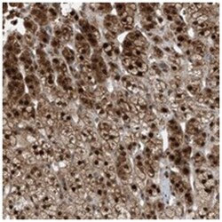 MAK10, Rabbit, Polyclonal Antibody, Abnova 100 &mu;L | Buy Online | Abnova Corporation | Fisher Scientific
