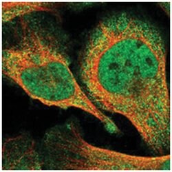 MAK10, Rabbit, Polyclonal Antibody, Abnova 100 &mu;L | Buy Online | Abnova Corporation | Fisher Scientific