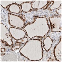 FLJ21865, Rabbit, Polyclonal Antibody, Abnova 100 &mu;L | Buy Online | Abnova Corporation | Fisher Scientific