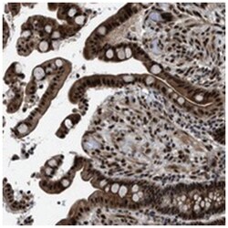 ZBTB10, Rabbit, Polyclonal Antibody, Abnova 100 &mu;L | Buy Online | Abnova Corporation | Fisher Scientific