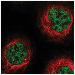 ZBTB10, Rabbit, Polyclonal Antibody, Abnova 100 &mu;L | Buy Online | Abnova Corporation | Fisher Scientific