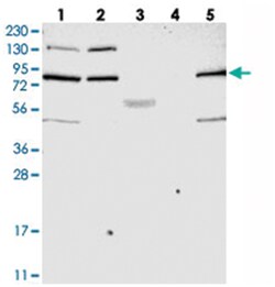 SMCR8 Rabbit anti-Human, Polyclonal Antibody, Abnova 100 &mu;L | Buy Online | Abnova Corporation | Fisher Scientific