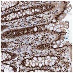SMCR8 Rabbit anti-Human, Polyclonal Antibody, Abnova 100 &mu;L | Buy Online | Abnova Corporation | Fisher Scientific