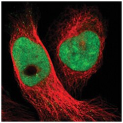 SMCR8 Rabbit anti-Human, Polyclonal Antibody, Abnova 100 &mu;L | Buy Online | Abnova Corporation | Fisher Scientific