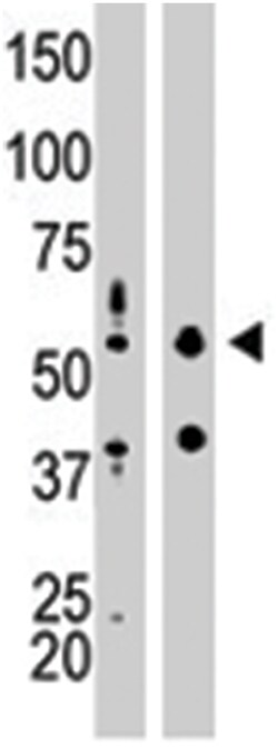 EIF2AK2 Rabbit anti-Human, Mouse, Polyclonal Antibody, Abnova 400 &mu;L | Buy Online | Abnova Corporation | Fisher Scientific