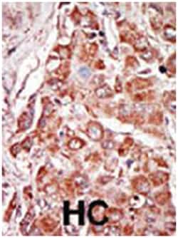 EIF2AK2 Rabbit anti-Human, Mouse, Polyclonal Antibody, Abnova 400 &mu;L | Buy Online | Abnova Corporation | Fisher Scientific