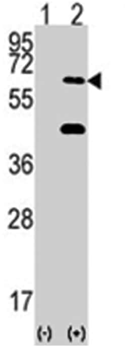 EIF2AK2 Rabbit anti-Human, Mouse, Polyclonal Antibody, Abnova 400 &mu;L | Buy Online | Abnova Corporation | Fisher Scientific