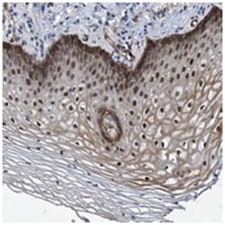 ZNF750 Rabbit anti-Human, Polyclonal Antibody, Abnova 100 &mu;L | Buy Online | Abnova Corporation | Fisher Scientific
