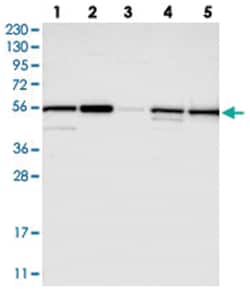 PMPCA, Rabbit, Polyclonal Antibody, Abnova 100&mu;L; Unlabeled:Antibodies,