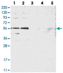 FAM116B Rabbit anti-Human, Polyclonal Antibody, Abnova 100 &mu;L | Buy Online | Abnova Corporation | Fisher Scientific