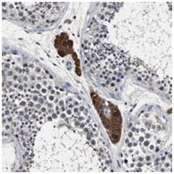 FAM116B Rabbit anti-Human, Polyclonal Antibody, Abnova 100 &mu;L | Buy Online | Abnova Corporation | Fisher Scientific