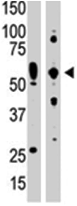 EIF2AK2 Rabbit anti-Human, Mouse, Polyclonal Antibody, Abnova 400 &mu;L | Buy Online | Abnova Corporation | Fisher Scientific